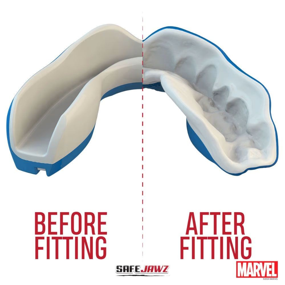 safejawz-marvel-captain-america-dislik-mouthguard-12-yas-alti-cocuklar-icin-1941.jpg safejawz-marvel-captain-america-dislik-mouthguard-12-yas-alti-cocuklar-icin-1941.jpg